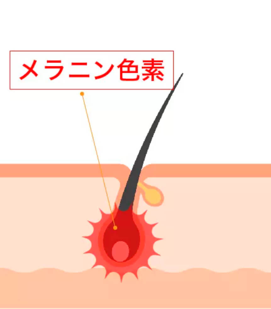 IPL脱毛機説明図