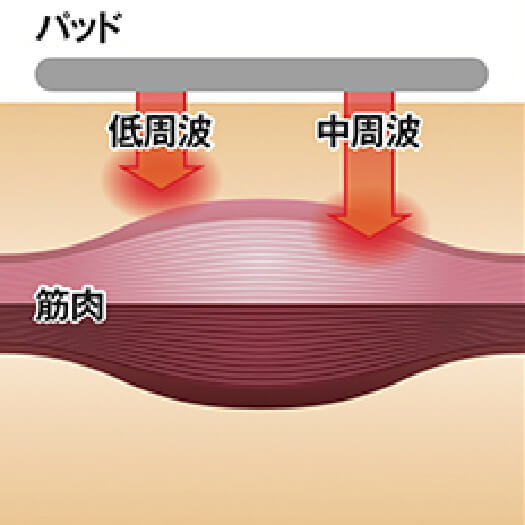 一般的なEMS図解